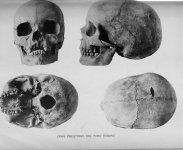 foroskull.jpg