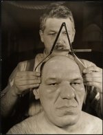 Bizygomatic.jpg